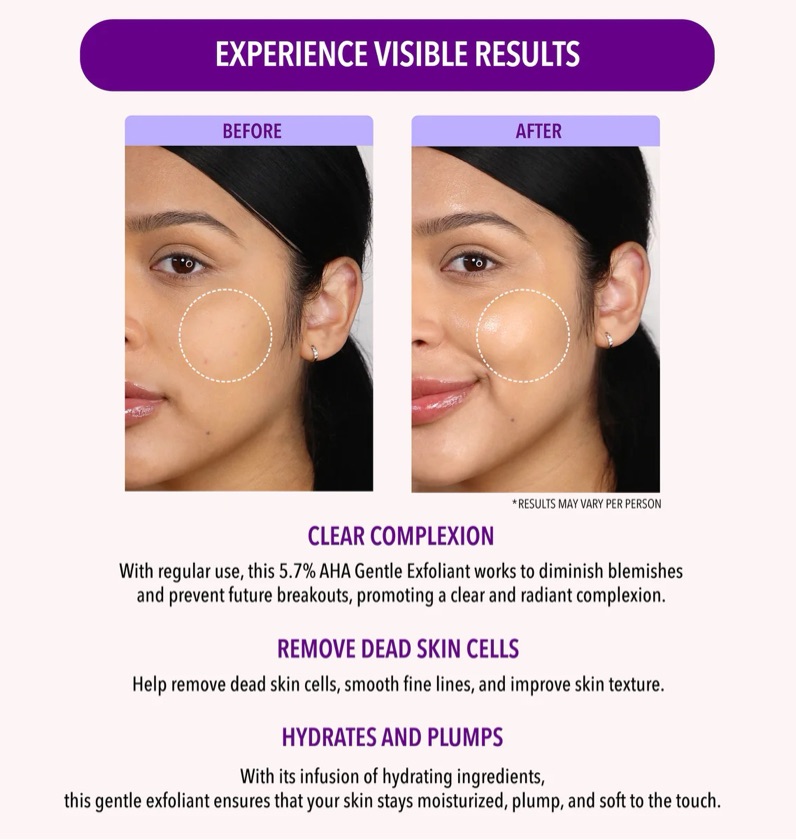 5.7% AHA GENTLE EXFOLIANT - MOIRA
