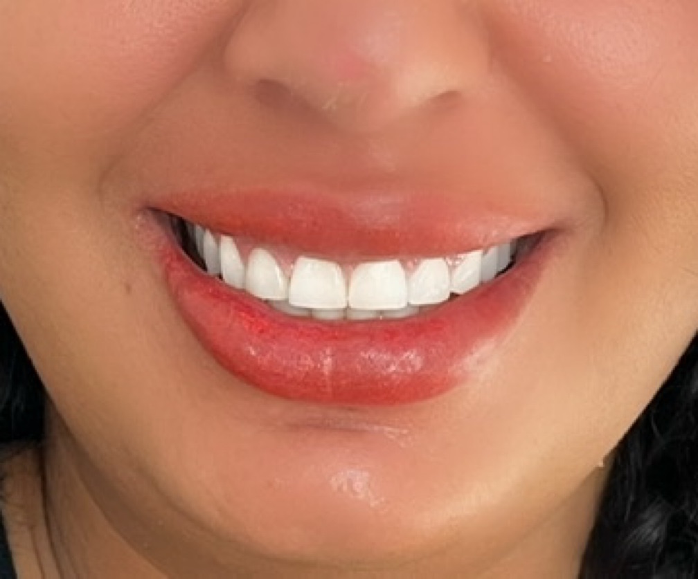 Micropigmentação labial
