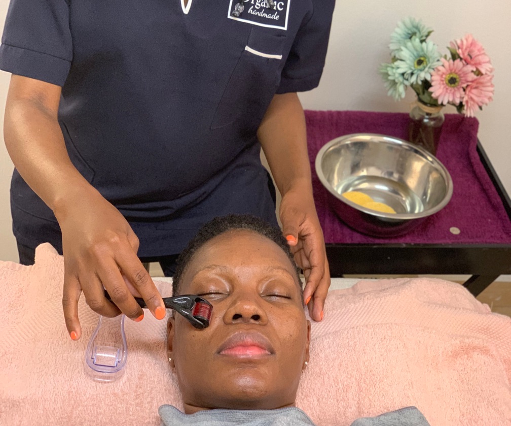 Microneedling session