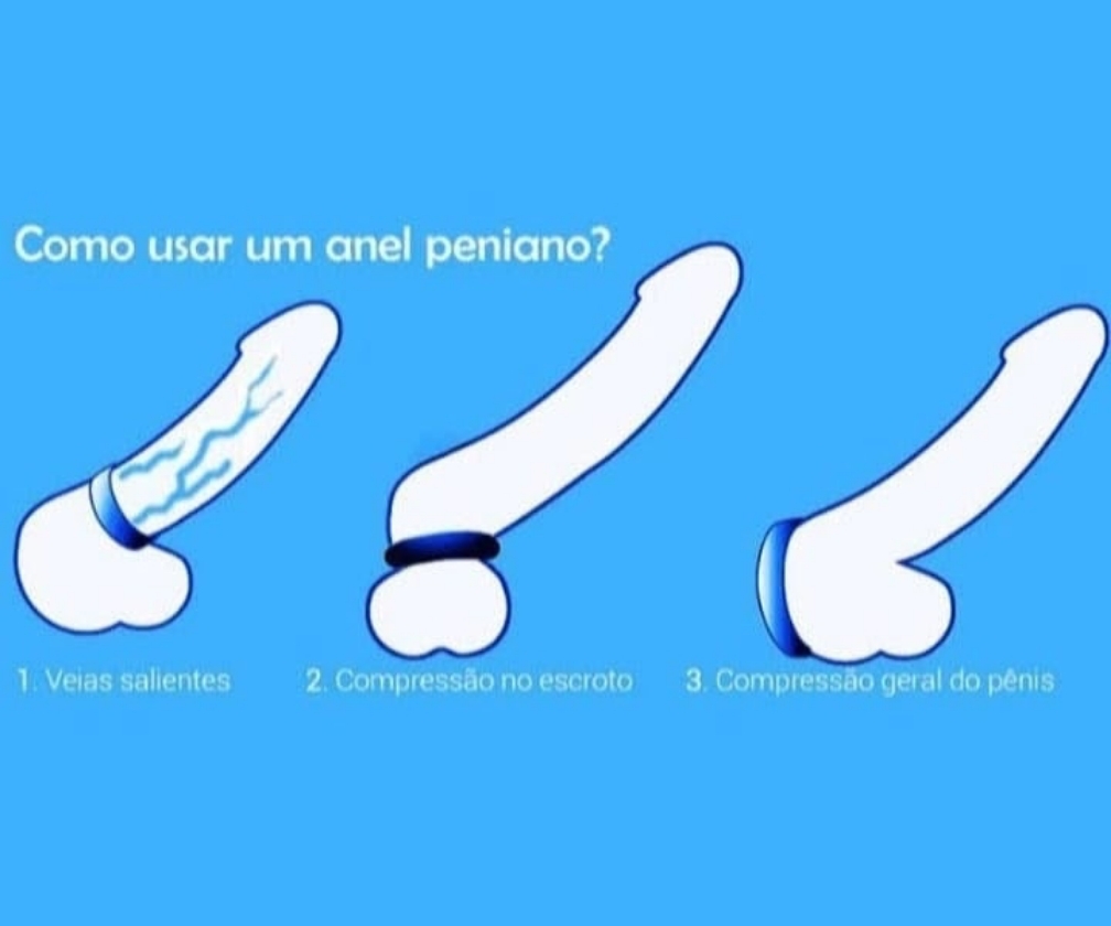 Anel Peniano