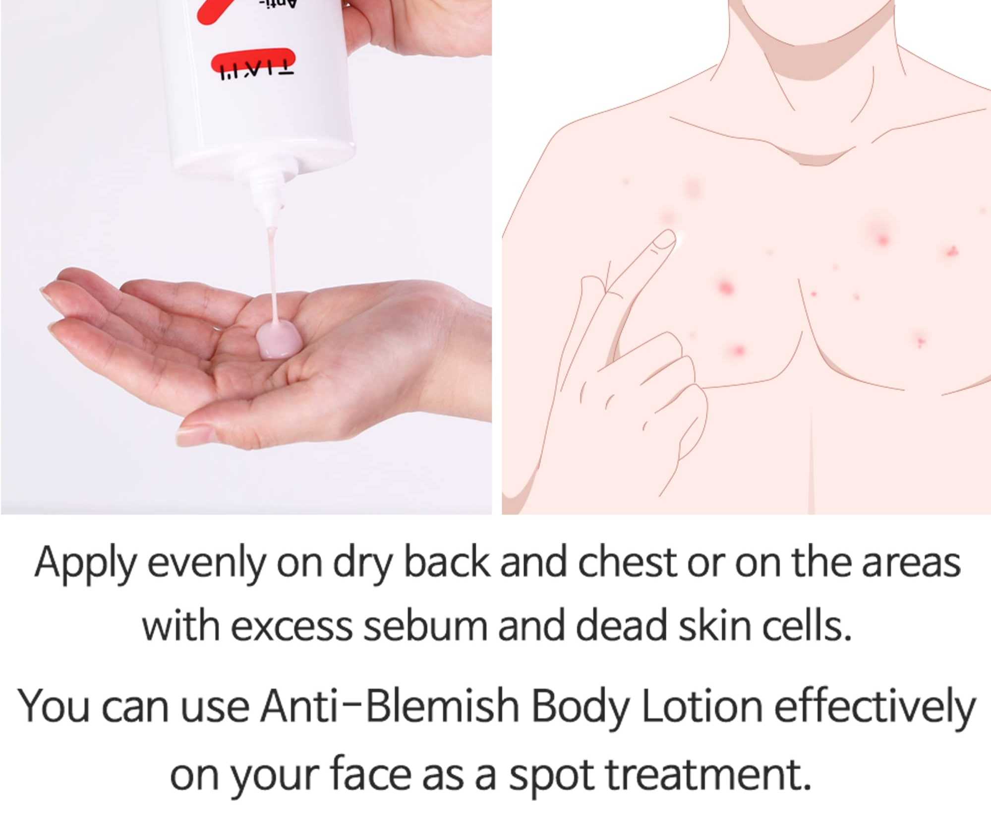 TIAM - Anti Blemish Body Lotion