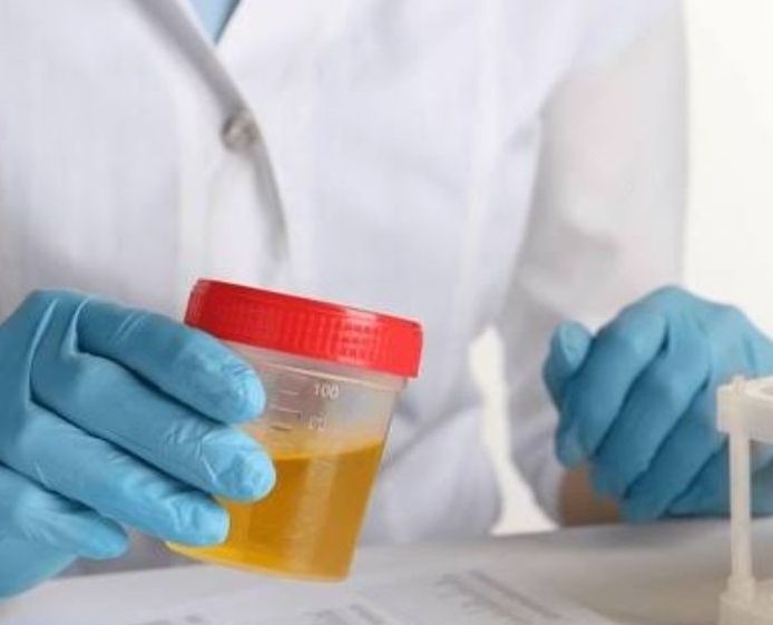 Urianalisis veterinario